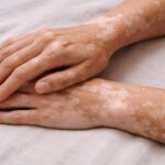 How OKDERMO Helps People Even Out Skin Tone